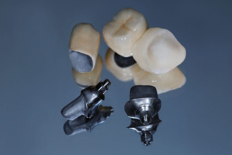 full mouth restoration in highlands