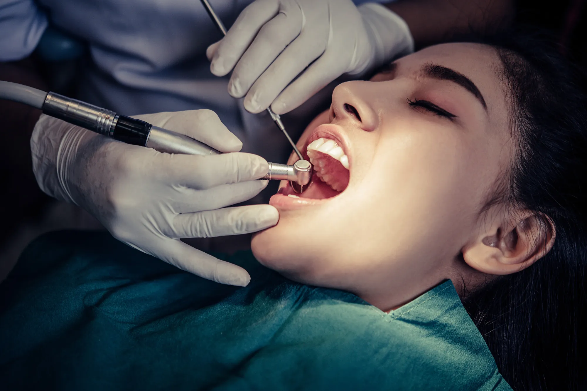 toot extraction admonton