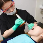 what to expect at bonded fillings