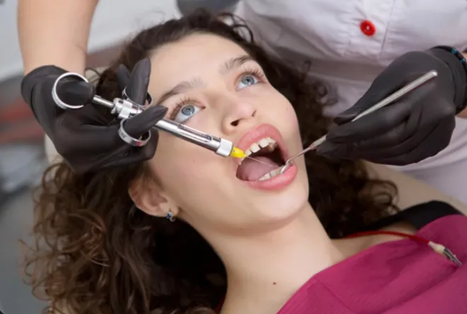 bonded fillings vs traditional fillings